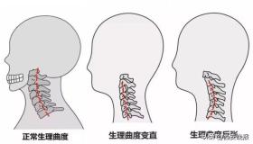 照片热传！不少年轻人在医院“吊脖子”？医生提醒